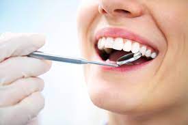 Smiles Central - Service - Dental Fillings