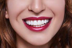 Smiles Central - Latest update - Smile Makeover Services In Bellandur